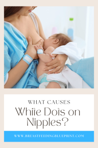 White dots on nipple