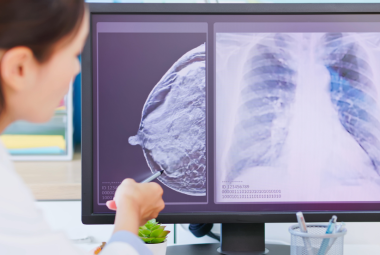 Breastfeeding and maternal breast infection prevention